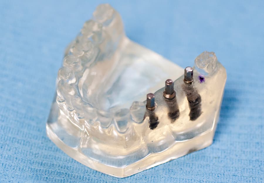 Clínica dental en O Rosal